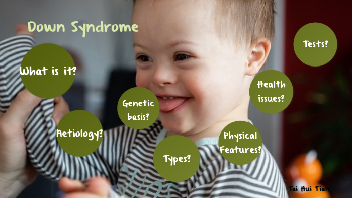 Down Syndrome by HT Tai on Prezi