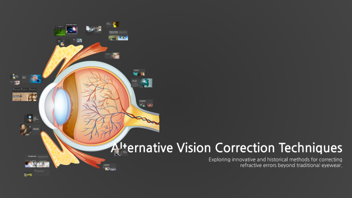 Alternative Vision Correction Techniques by 유나 최 on Prezi