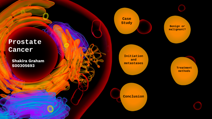 Shakira Graham BIOL122 AT2 Prostate Cancer by Shakira Graham