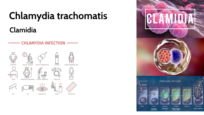 Clamidia by Federico Camotti on Prezi