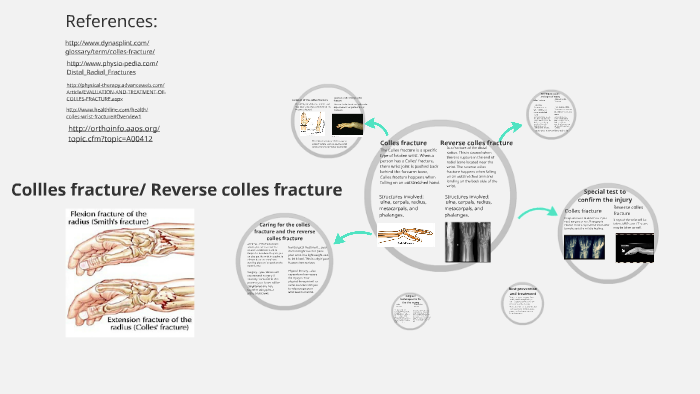 colles fracture healing time