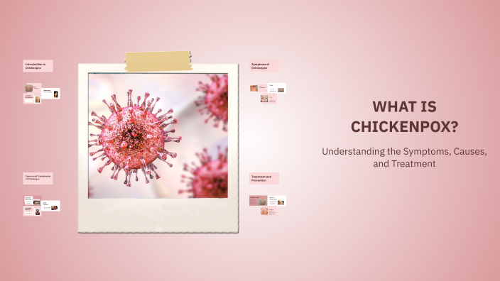 WHAT IS CHICKENPOX? by Marely Guzmán on Prezi