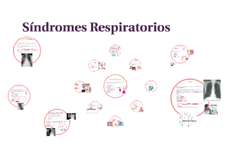 Síndromes Respiratorios by Maura Patricia Campa Córdoba on Prezi