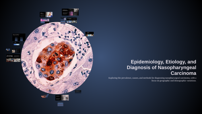 Epidemiology, Etiology, and Diagnosis of Nasopharyngeal Carcinoma by ...