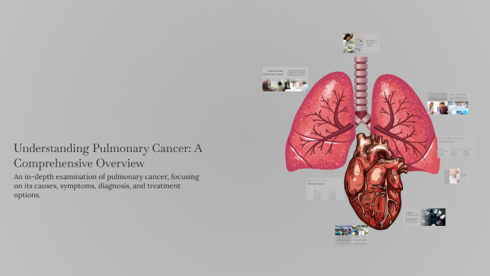 Understanding Pulmonary Cancer: A Comprehensive Overview by Anastasia ...