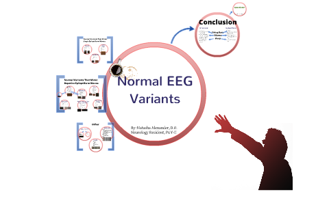 Normal Variants in the Electroencephalogram by Natasha Alexander on Prezi
