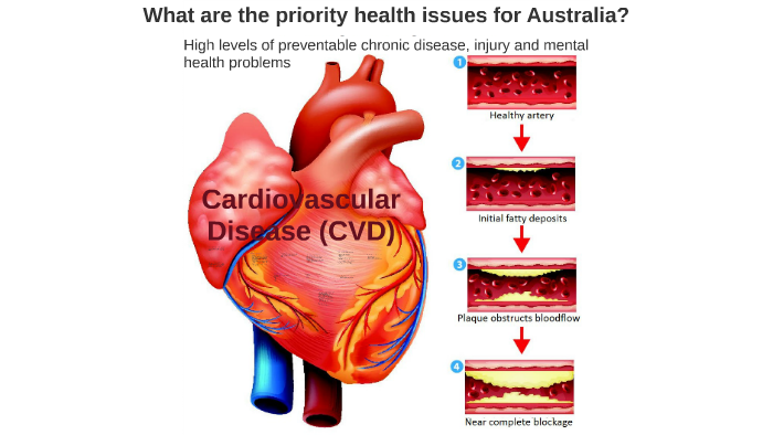 What are the priority health issues for Australia? by Craig whiteman on ...