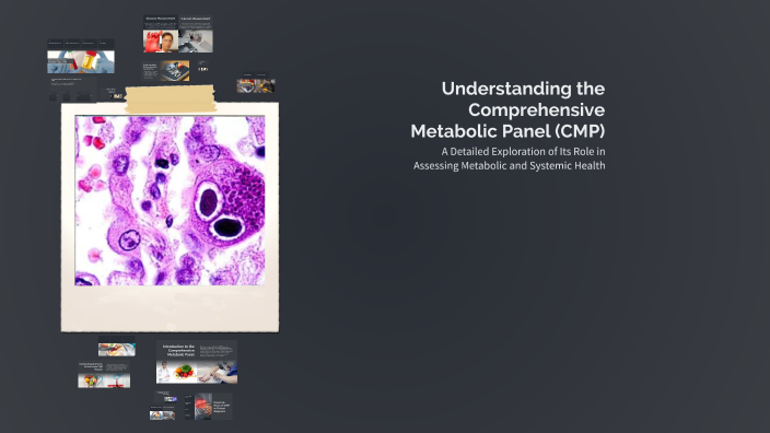 Understanding the Comprehensive Metabolic Panel (CMP) by Sandy Walker ...