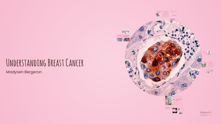 Understanding Breast Cancer by Madysen Bergeron on Prezi