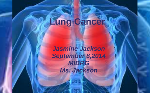 Lung Cancer by Jasmine Jackson on Prezi