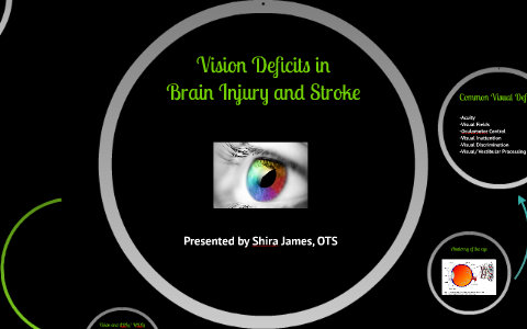 Vision deficits with Brain Injury and Stroke by Shira James on Prezi