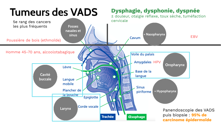 Tumeurs des VADS by Margaux Qu on Prezi