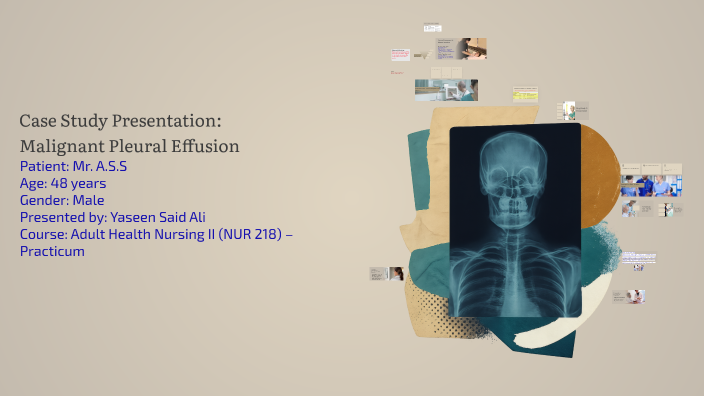 Case Study Presentation: Malignant Pleural Effusion by Yaseen Said on Prezi