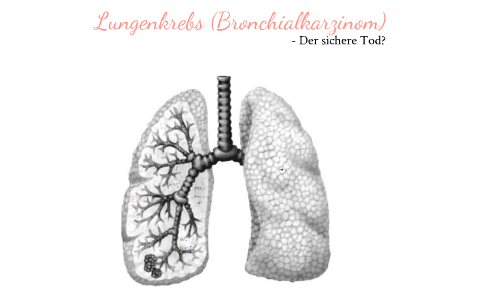 Lungenkrebs (Bronchialkarzinom) - Der sichere Tod? by Antonia Rinke on ...