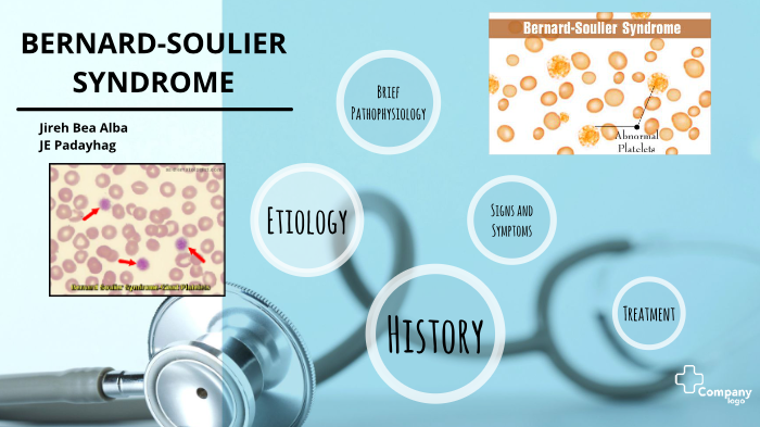 BERNARDSOULIER SYNDROME by Jireh Bea Alba on Prezi