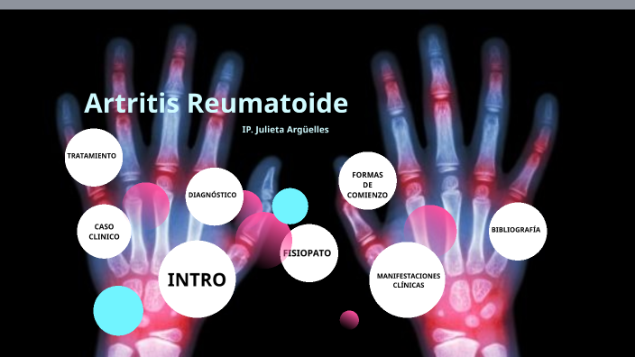 ARTRITIS REUMATOIDE by julieta argüelles on Prezi