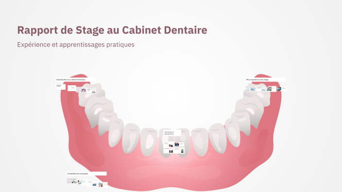 Rapport de Stage au Cabinet Dentaire by fabian chetrus on Prezi
