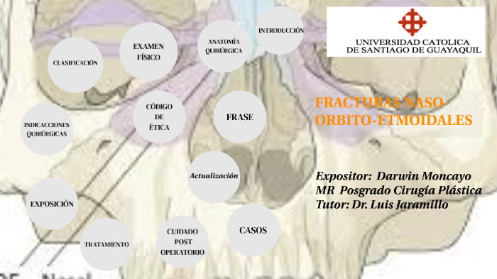 FRACTURAS DE NOE by Darwin Moncayo on Prezi