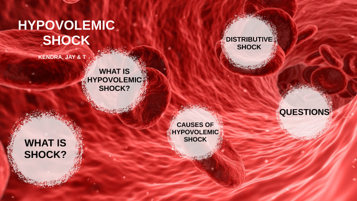 hypovolemic-shock-by-tiauna-hanson