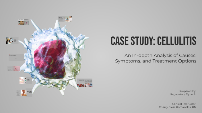 Understanding Cellulitis: A Case Study by Dianne Negapatan on Prezi