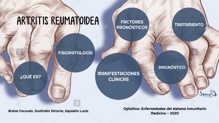 ARTRITIS REUMATOIDE by lucia esposito on Prezi