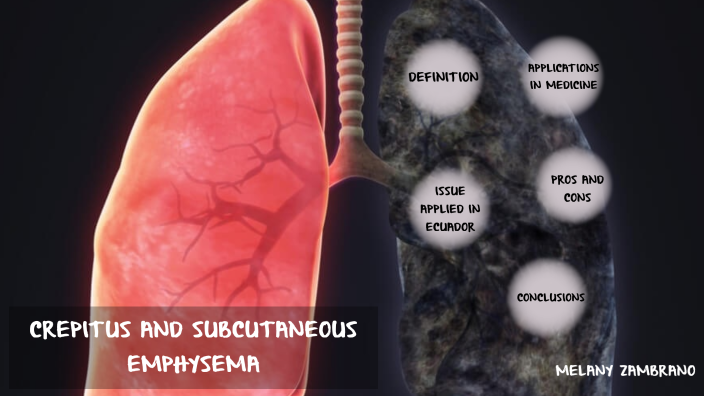 CREPITUS AND SUBCUTANEOUS EMPHYSEMA by Melany Karla Zambrano Torres on ...