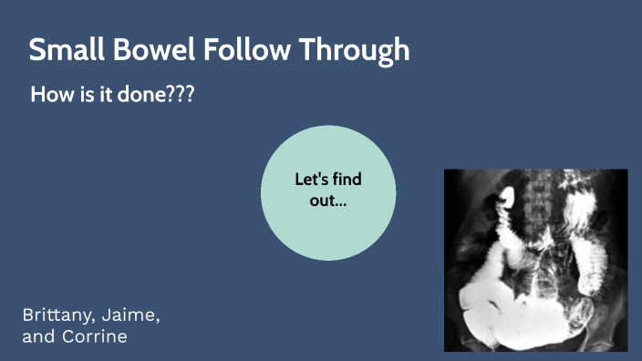 Small Bowel Follow Through by Corrine Mendall on Prezi