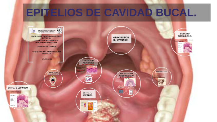 Epitelios De Cavidad Bucal By Karitina Gonz Lez On Prezi