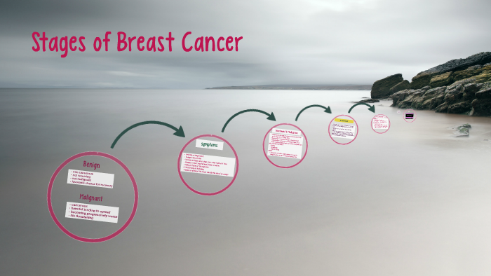 Stages of Breast Cancer by yahaira sanchez on Prezi