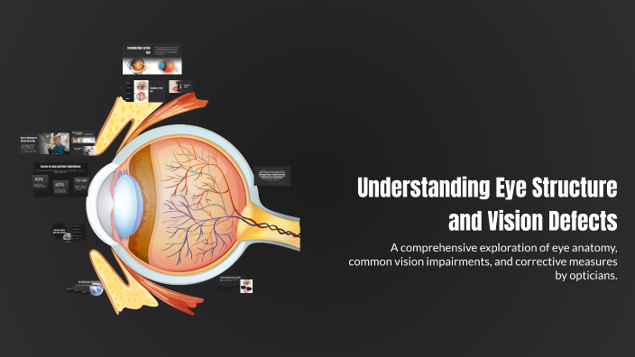 Understanding Eye Structure and Vision Defects by jack edmonds on Prezi
