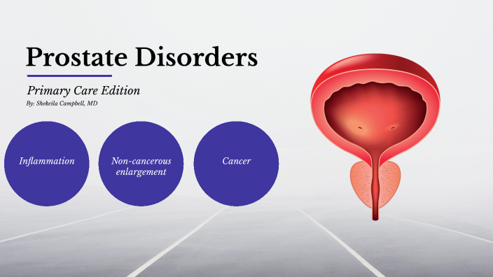 Prostate Disorder by Shekeila Campbell on Prezi