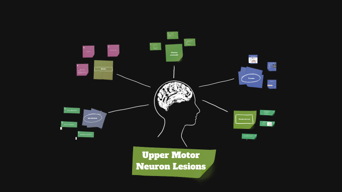 Upper Motor Neuron Lesions by Dani Vonnák on Prezi