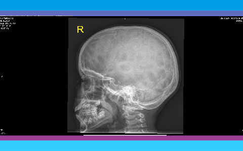 Copper beaten skull by Raed Alotaibi on Prezi