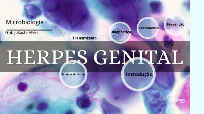 Herpes Genital By Arianna Araujo On Prezi Next