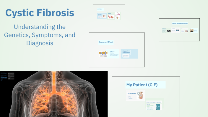 Cystic Fibrosis by Ali El Kadri on Prezi