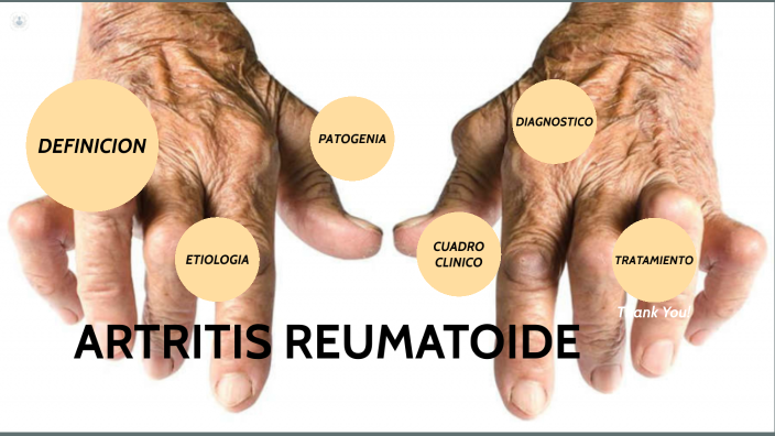 ARTRITIS REUMATOIDE by Chayito Apala Zota on Prezi