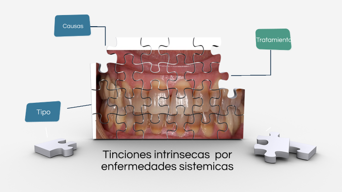 Tinciones intrínsecas por enfermedades sistémicas by Noelia Sánchez ...