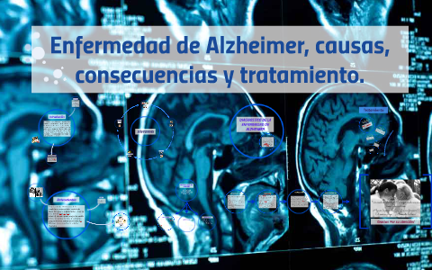 Enfermedad De Alzheimer, Causas, Consecuencias Y Tratamiento By Karla 