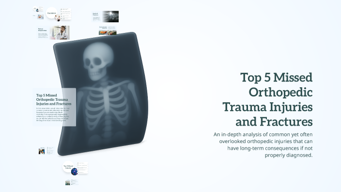 Top 5 Missed Orthopedic Trauma Injuries and Fractures by ibrahim zalat ...