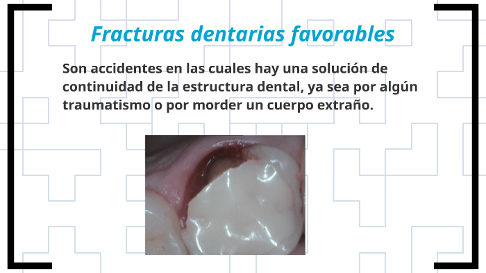 Fracturas Dentarias By Dt Td