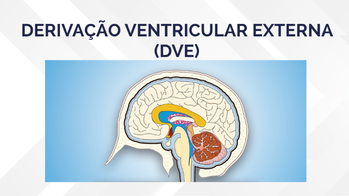 DVE by Anna Beatriz on Prezi