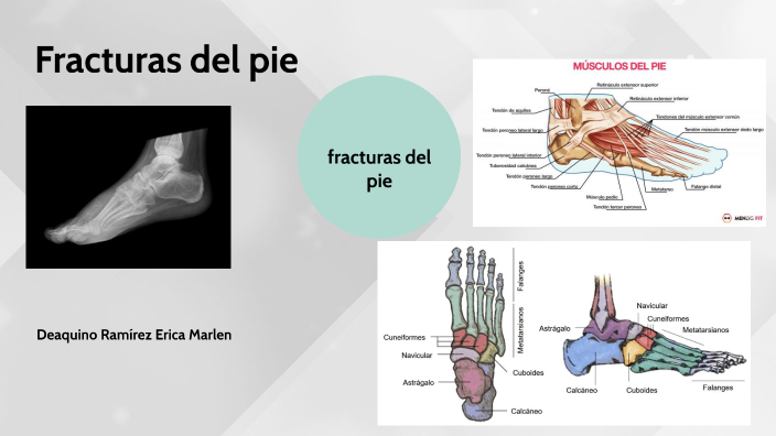 pie hueso anatomía cuboides fx