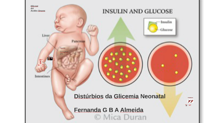 Distúrbios da Glicemia Neonatal by Fernanda Gabriella on Prezi