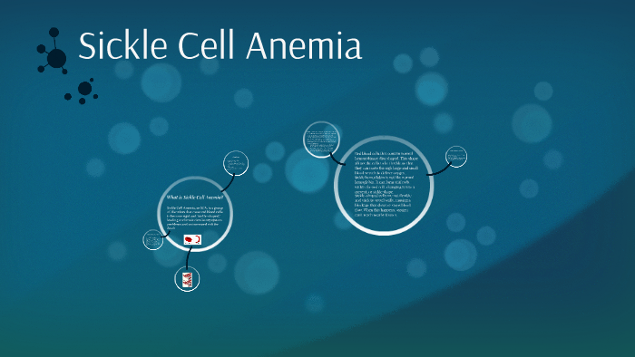 Sickle Cell Anemia (SCA) by Haylee Minix