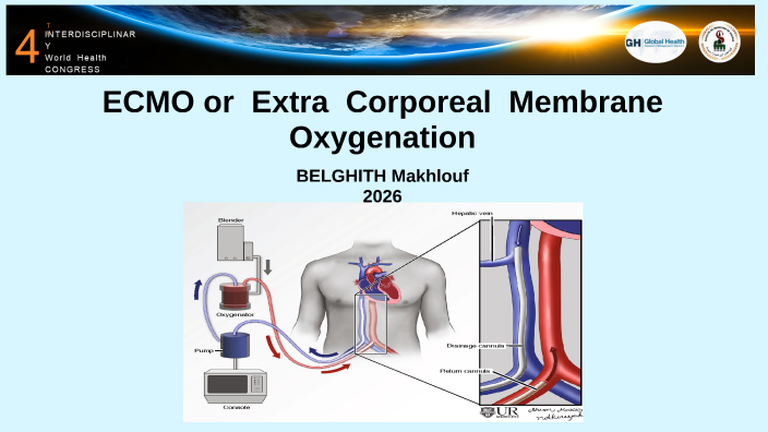 ECMO or Extra Corporeal Membrane Oxygenation is a form of ...