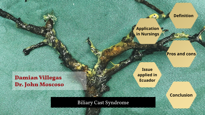 Biliary Cast Syndrome by DAMIAN VILLEGAS on Prezi