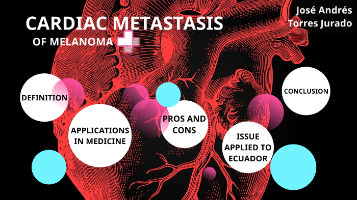 Cardiac Metastases In Melanoma By Jose Andres Torres Jurado On Prezi