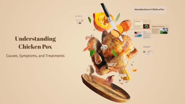 Understanding Chicken Pox by 2031 ADJEPONG Heaven on Prezi