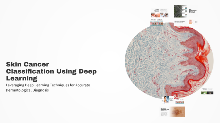 Skin Cancer Classification Using Deep Learning by RAVIRAJSINH VANSIA on ...