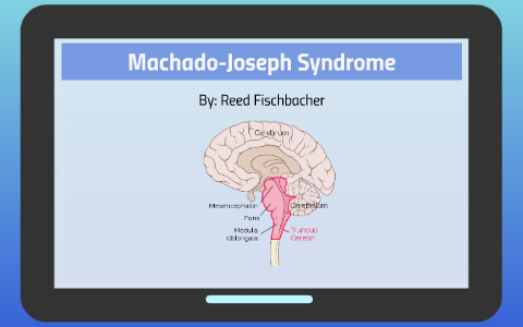 Machado-Joseph Syndrome by Reed Fischbacher